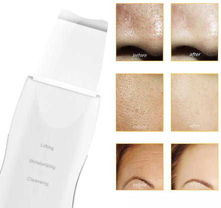 Kavitacinio odos šveitimo įrenginys