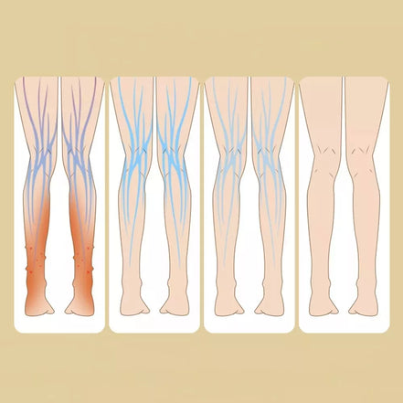 Elektrinis blauzdos masažuoklis